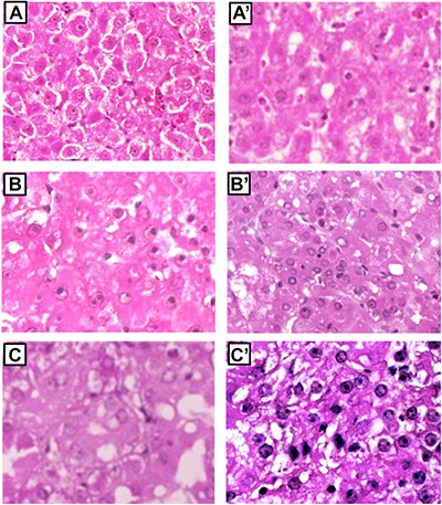 Preneoplastic and neoplastic liver lesion of F344 and BN rats.