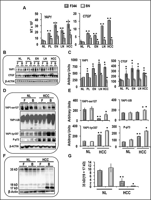 Expression and post-translational modifications of YAP1 in preneoplastic and neoplastic rat liver lesions induced in rats by &lsquo;&lsquo;resistant hepatocyte&rsquo;&rsquo; protocol.