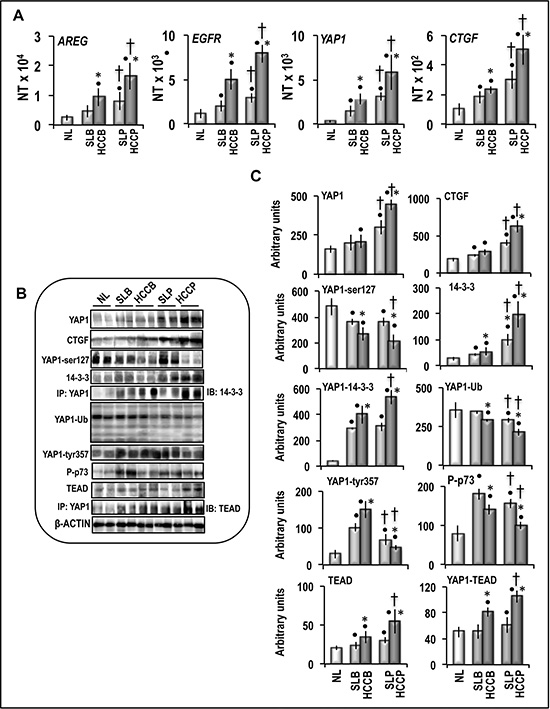 Expression of AREG/EGFR/YAP/CTGF pathway and post-translational modifications of YAP1 in human normal liver (NL), HCC, and corresponding surrounding liver (SL).