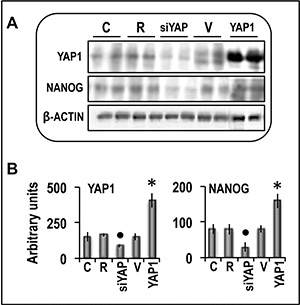Analysis of the effect of YAP1 inhibition by specific siRNA or forced overexpression on the expression of NANOG protein in human Hep3B liver cancer cells.