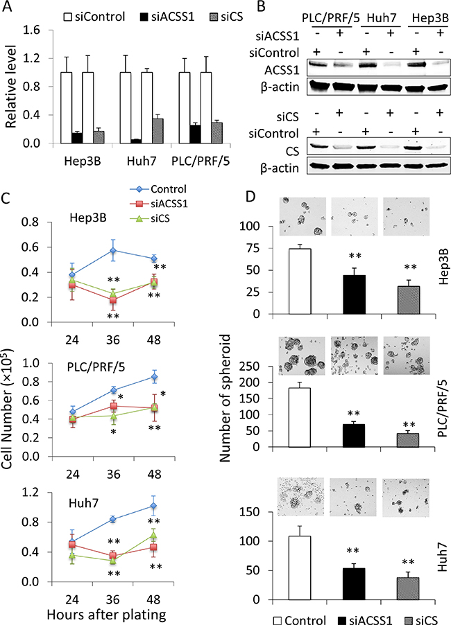 Knock-down of CS or ACSS1 is able to decrease the malignant characteristics of HCC cells.