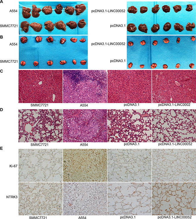 Role of LINC00052 in tumor migration in vivo.