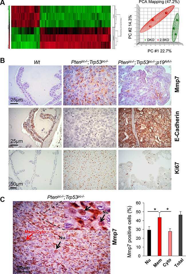 Mmp7 is elevated in prostate cancer of Pten/Trp53 mice but decreased by loss of p19Arf in vivo.