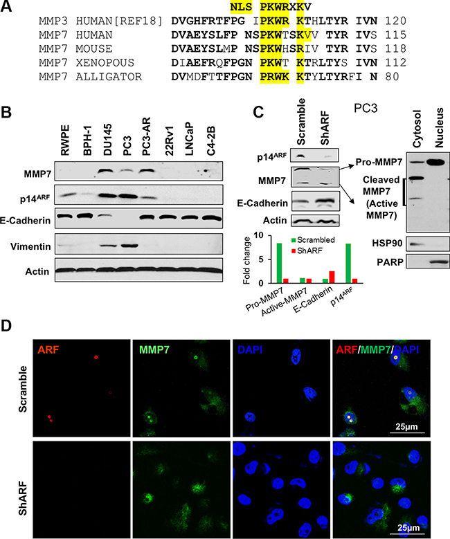 The expression and nuclear localization of MMP7 are decreased by p14ARF knockdown in human prostate cancer cells.