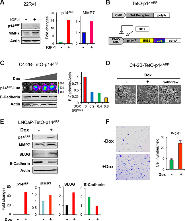 p14ARF overexpression increases MMP7 levels with a decrease of E-Cadherin in human prostate cancer cells.