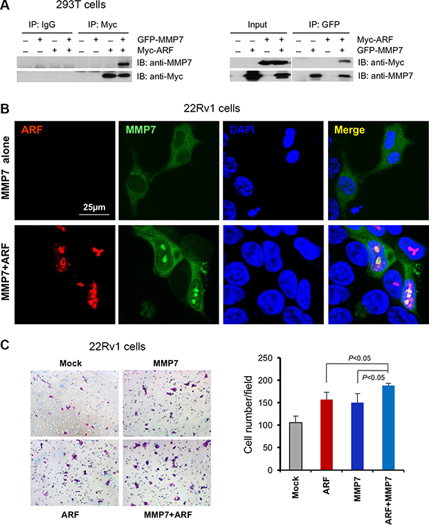 MMP7 interacts with ARF in nucleus to promote cell migration of human prostate cancer cells.