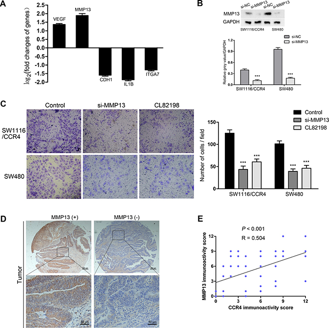 MMP13 plays a crucial role in CRC cells invasion mediated by CCR4.