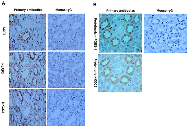 Localization analyses of NLRP3 and mPGES-1 in renal biopsy specimens of the proteinuric patients by immunohistochemistry.