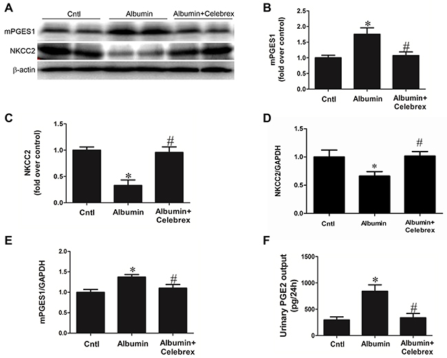 Celebrex treatment reversed the albuminuria-induced alteration of NKCC2 and involved signaling pathway.