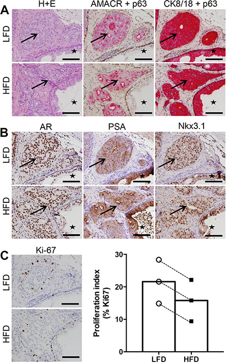 High fat feeding does not promote increased proliferation in patient-derived xenograft tissue.