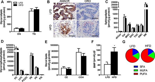Lipidomic analysis reveals no effect of obesity on lipid deposition in the prostate cancer xenografts in SCID mice.