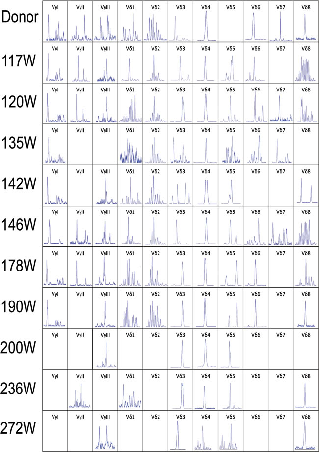 CDR3 spectratyping of the TCR V&#x3b3; and V&#x3b4; subfamily T cells in peripheral blood from the donor and recipient (117 to 272 weeks post-HSCT) at different time points after allo-HSCT.