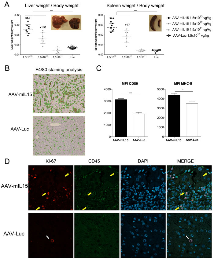 AAV-mIL15 administration is associated with the development of hepatosplenomegaly.