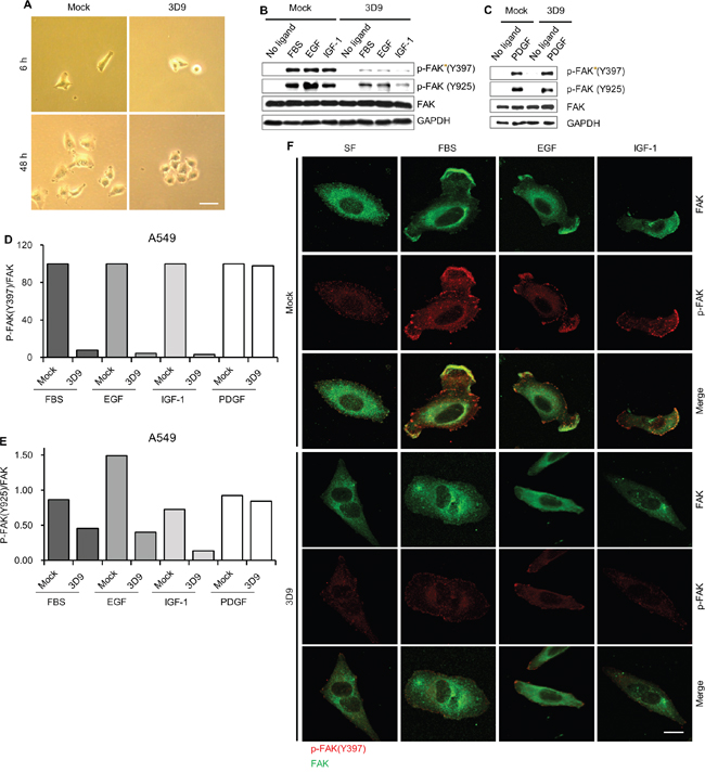 Antibody neutralization of gC1qR prevents the activation of focal adhesion kinase (FAK).