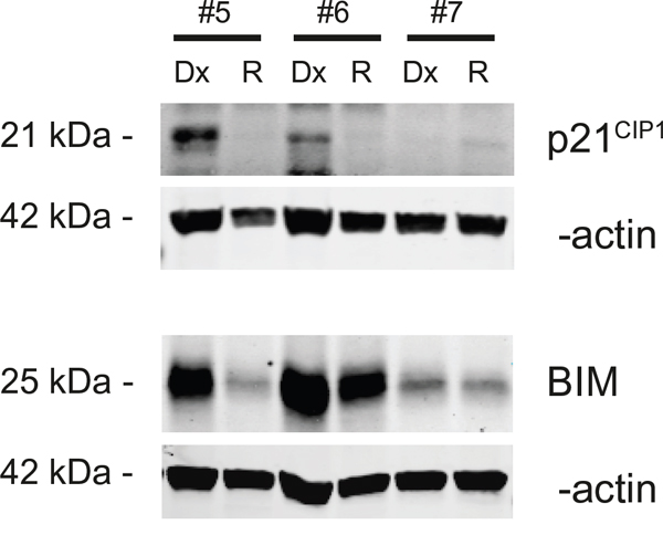 Protein expression anaylis of p21WAF1/CIP1 and BIM with Western blot.