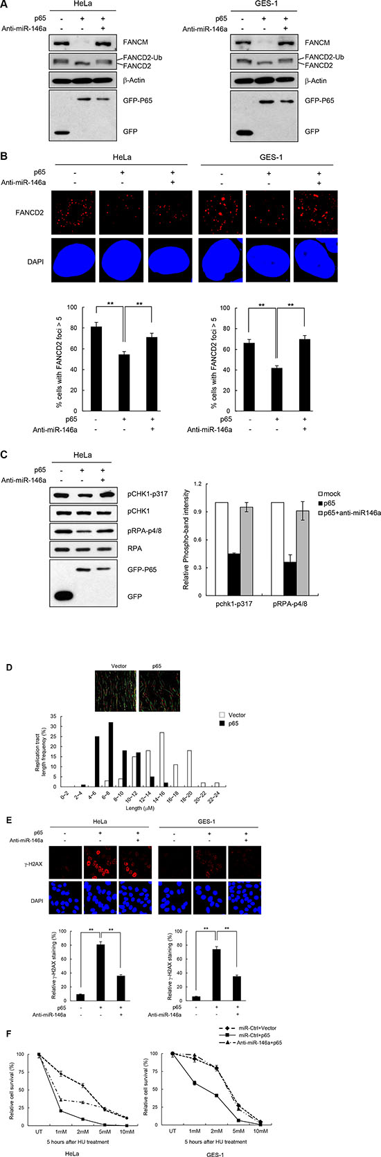 NF-&#x03BA;B reiterating miR146a function in the FA pathway and replication fork restart.