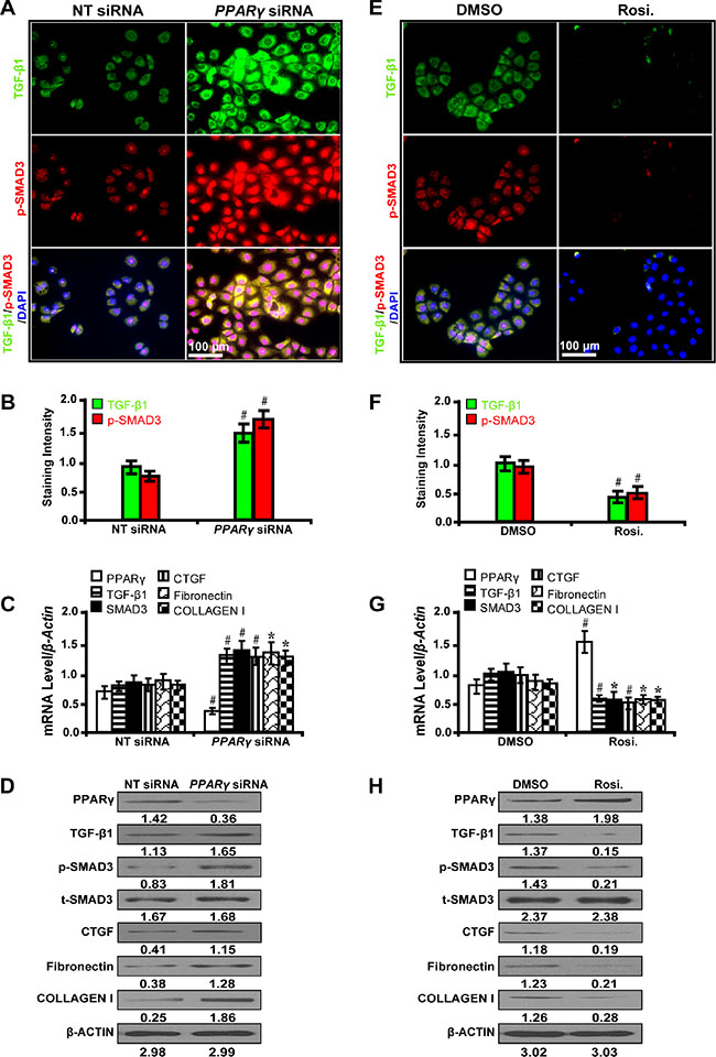 PPAR&#x03B3; attenuates TGF-&#x03B2;/SMAD3-induced fibrosis in high glucose cultured NRK-52E cells.