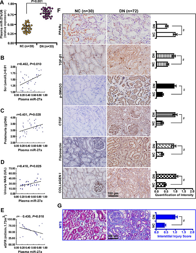 Elevated plasma miR-27a reflects unfavorable renal function and increased tubulointerstitial fibrosis in DN patients.