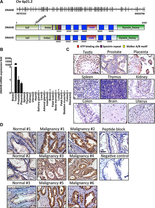 DNAH8 mRNA expression and protein abundance in normal human tissues and prostate cancer.