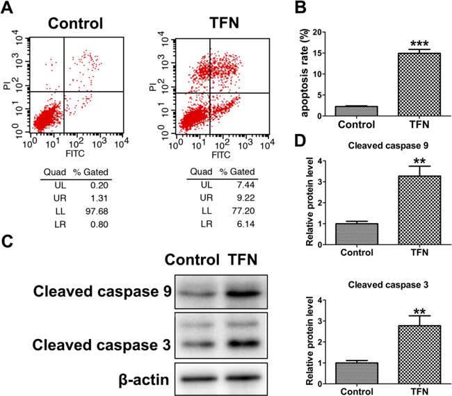 The pro-apoptotic effect of Teriflunomide (TFN, a specific inhibitor of DHODH) on HL-60 cells.