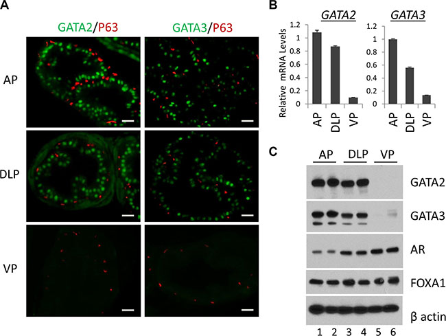 Expression of the GATA and other key transcription factors in WT murine prostate.