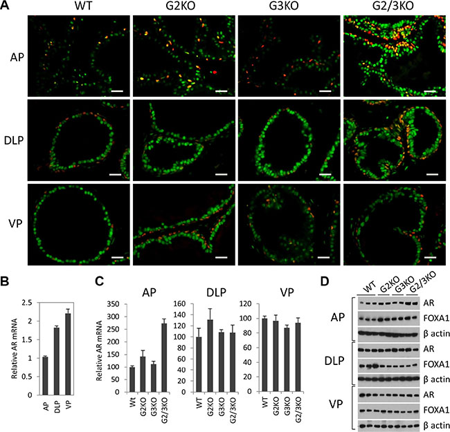 AR expression in luminal and basal epithelial cells in different prostatic lobes in WT and GATA KO mice.