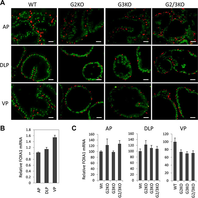 FoxA1 expression in different prostatic lobes of WT and GATA knockout mice.