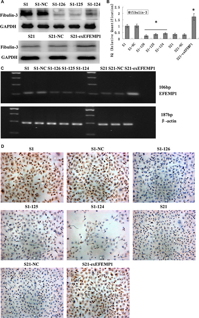 Identification of the efficiencies of EFEMP1 overexpression and knockdown after transfection (S1 and S21: non-infected control, S1-NC and S21-NC: infected with control-shRNA, S1-124: infected with EFEMP1-shRNA 124, S1-125: infected with EFEMP1-shRNA 125, S1-126: infected with EFEMP1-shRNA 126, and S21-exEFEMP1: infected with pLVX- EFEMP1-Puro vector).