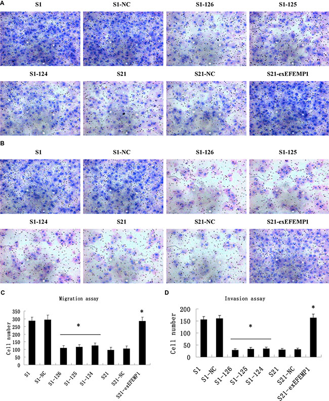 Effects of EFEMP1 on cell migration and invasion.