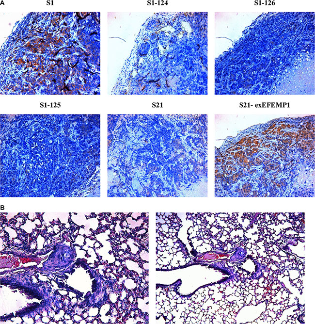 Effects of EFEMP1 on metastasis in nude mice.