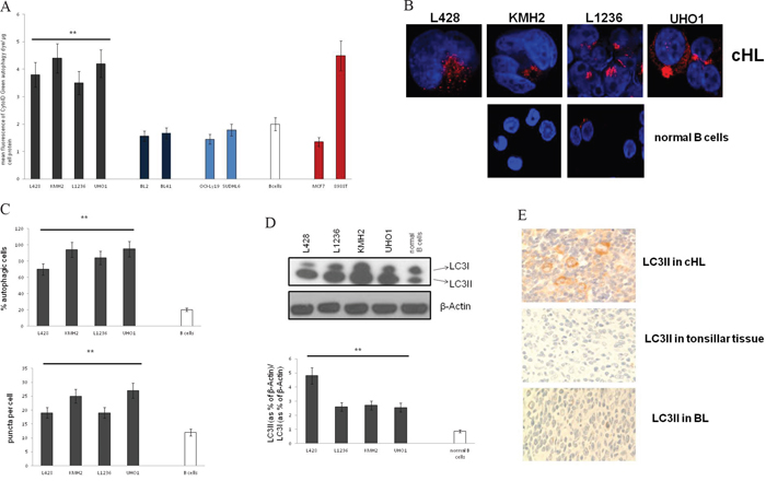 LC3 processing and the number of autophagosomes are increased in cHL.