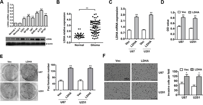 LDHA is up-regulated and promotes cell proliferation and invasion in glioma.