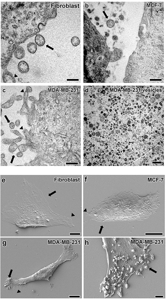 Vesicular structure characterization by electron microscopy.