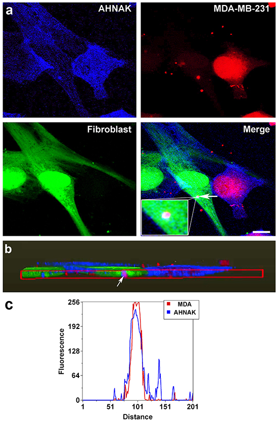 AHNAK localization in vesicles transferred from MDA-MB-231 cells to nontransformed fibroblasts.