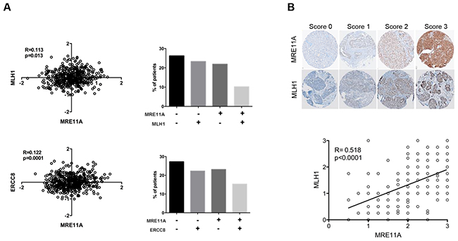 Correlations between expression levels of DNA repair genes in clinical samples.