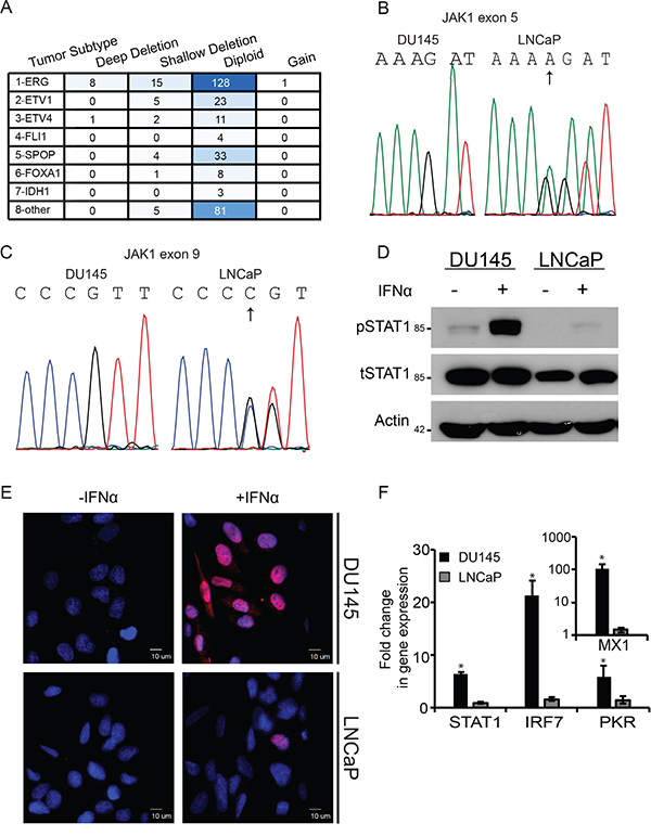 Deficient JAK1 expression characterizes a subset of prostate cancer patient samples and LNCaP cells, and correlates with lack of IFN signaling.