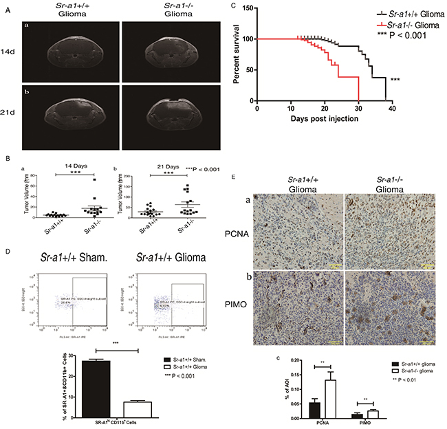 SR-A1 deficiency promotes orthotopic glioma growth and malignancy in mice.