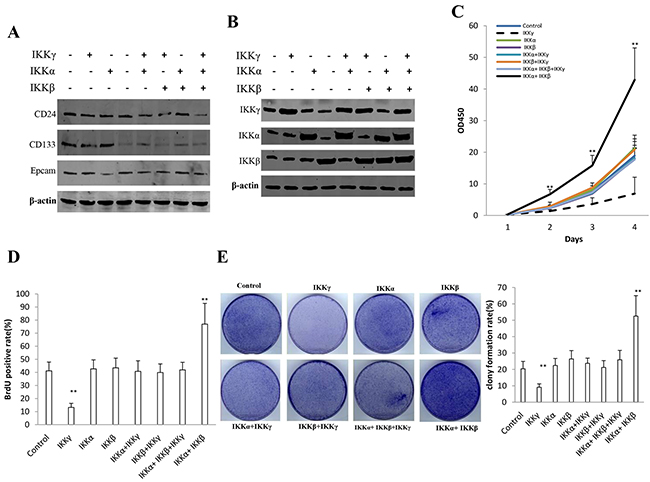 IKK&#x03B1;, IKK&#x03B2;, IKK&#x03B3; influence on human liver cancer stem cells (hLCSC) growth in vitro.