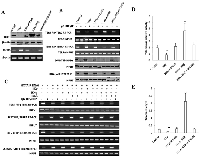 HOTAIR depletion blocks IKK&#x03B1;, IKK&#x03B2;, IKK&#x03B3; function on telomere.