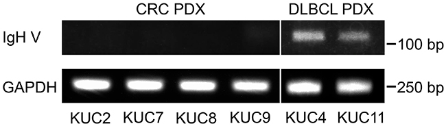IgH gene rearrangements in the DLBCL PDXs.