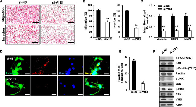 Depletion of V-ATPase V1E1 inhibits migration, invasion, and formation of focal adhesions by TE8 esophageal cancer cells.