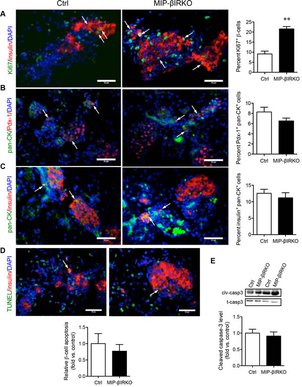 Fetal MIP-&#x3b2;IRKO mice show increased &#x3b2;-cell proliferation with no change in apoptosis.