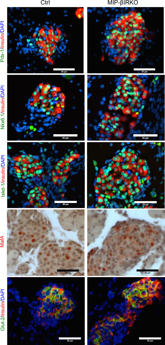 &#x3b2;-cells of fetal MIP-&#x3b2;IRKO islets display typical markers of &#x3b2;-cell identity and function.