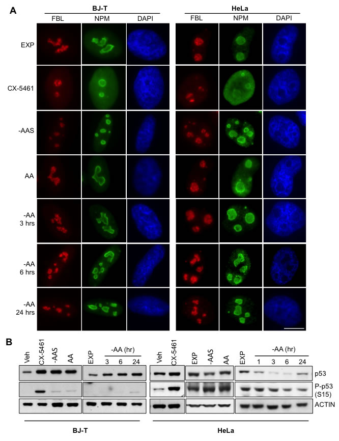 Inhibition of rDNA transcription following amino acid depletion does not affect nucleolar integrity.