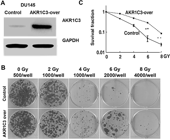Cell-based evaluation of the role of AKR1C3 on the response of prostate cancer cells to irradiation.
