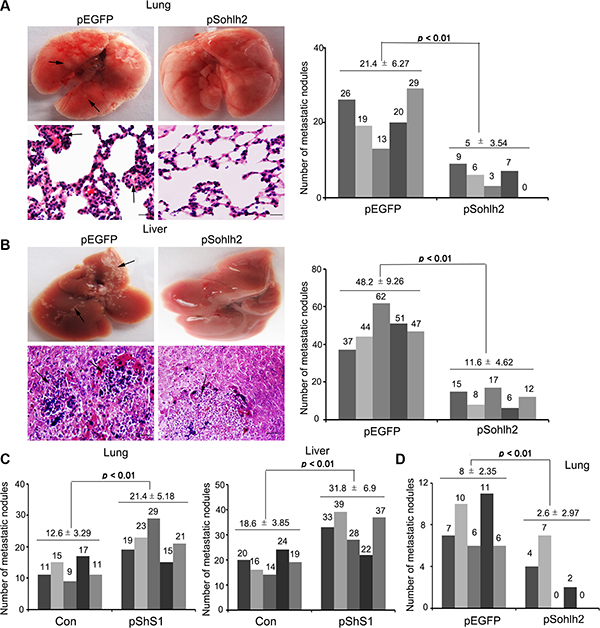 Sohlh2 inhibits breast cancer metastasis in mice.