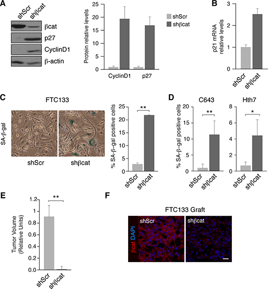 &#x03B2;-catenin inhibition induces cell senescence and reduces tumor growth in human tumoral thyroid cells.