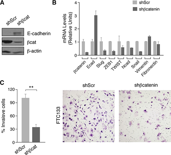 &#x03B2;-catenin silencing decreases expression of EMT markers and inhibits cell migration of human thyroid tumoral cells.