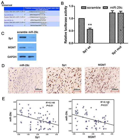 MiR-29c indirectly target MGMT in human glioma.