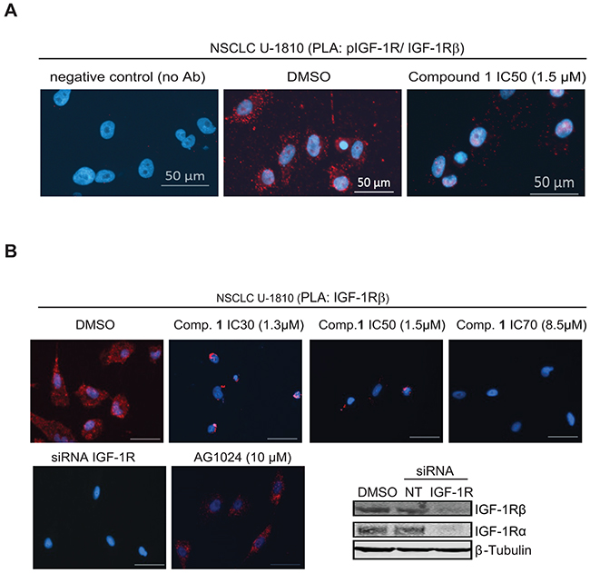Proximity ligation assay demonstrates inhibition of phosphorylation and degradation of IGF-1R &#x03B2; in tumor cells but not normal diploid fibroblasts upon treatment with compound 1.